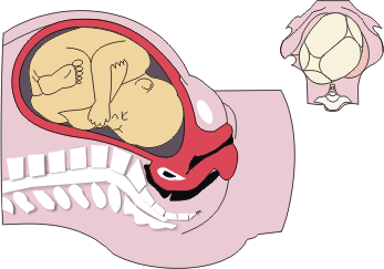 Posição do feto intra-útero antes de iniciar o trabalho de parto
