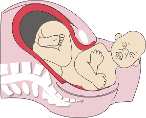 Feto desprendendo o ombro posterior