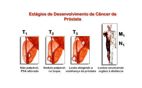 Gravidade da Doença