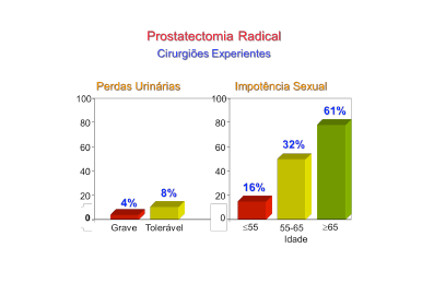 Prostatectomia Radical